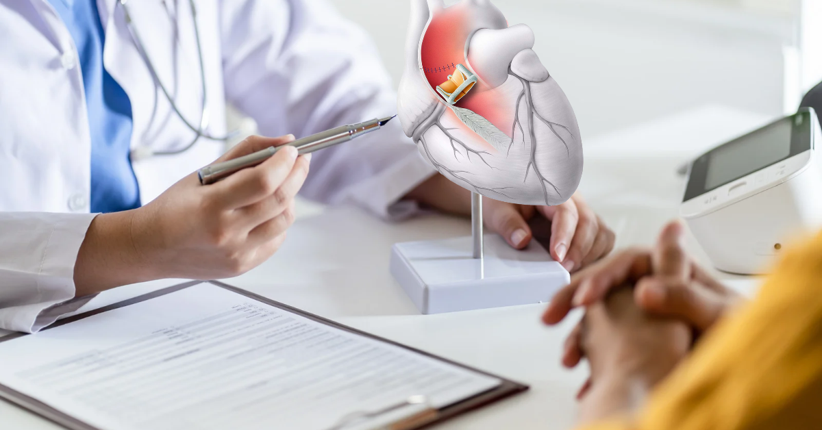 Top 5 Technologies used for Aortic Valve Replacement